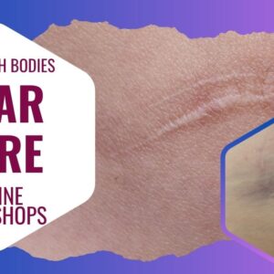 Soft Touch Bodies Scar Care Online Workshops. Blue-purple background with images of scars on pale skin.