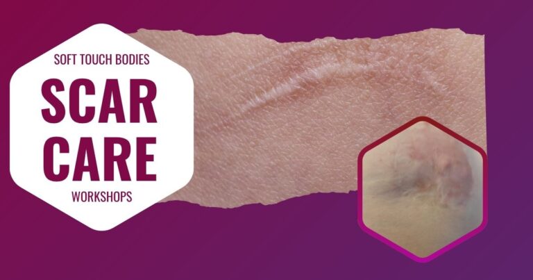 Soft Touch Bodies Scar Care Workshops. Pink background with images of scars on pale skin.