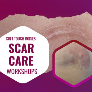 Soft Touch Bodies Scar Care workshops; a scar is seen in the midst of purple.